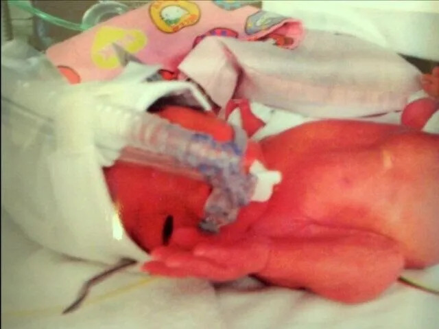 双子の長女に続き、1347ｇで生まれた長男も脳性まひに。歩行に困難があることを理由に入園できる幼稚園がないっ！